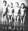 Дети, жертвы экспериментов доктора SS Джозефа Менгеля